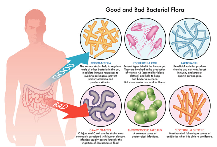 Probiotics With the Foods Improves Bowel Movement in Chronic Constipation Patients